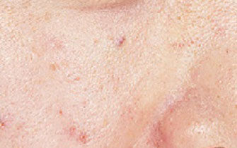 面部去角質磨砂膏 面部去角質磨砂膏