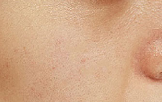 面部去角質磨砂膏 面部去角質磨砂膏